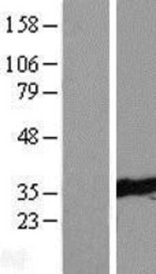 Western Blot: TTC33 Overexpression Lysate (Adult Normal) [NBL1-17408] Left-Empty vector transfected control cell lysate (HEK293 cell lysate); Right -Over-expression Lysate for TTC33.