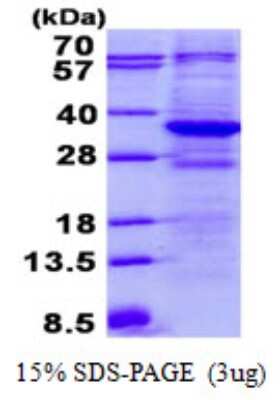 SDS-PAGE Recombinant Human TTC33 His Protein