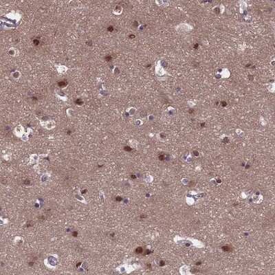 Immunohistochemistry-Paraffin: TTC35 Antibody [NBP2-13490] - Staining of human cerebral cortex shows strong nuclear positivity in neuronal cells.