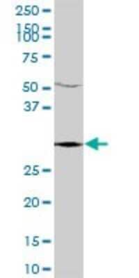 Western Blot: TTC35 Antibody [H00009694-B01P] - Analysis of KIAA0103 expression in human placenta.