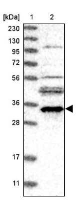 Western Blot: EMC2 Antibody [NBP2-13490] - TTC35 Antibody [NBP2-13490] - Lane 1: Marker  [kDa] 230, 130, 95, 72, 56, 36, 28, 17, 11.  Lane 2: Human cell line RT-4.