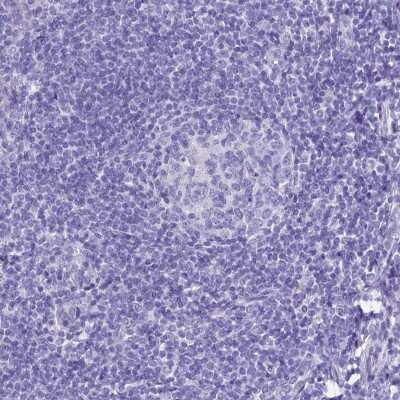 Immunohistochemistry-Paraffin: TTC36 Antibody [NBP1-93702] - Staining of human tonsil shows low expression as expected.