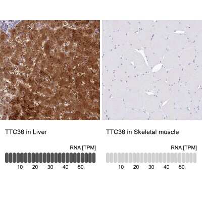 Immunohistochemistry-Paraffin: TTC36 Antibody [NBP1-93702] - Analysis in human liver and skeletal muscle tissues using NBP1-93702 antibody. Corresponding TTC36 RNA-seq data are presented for the same tissues.