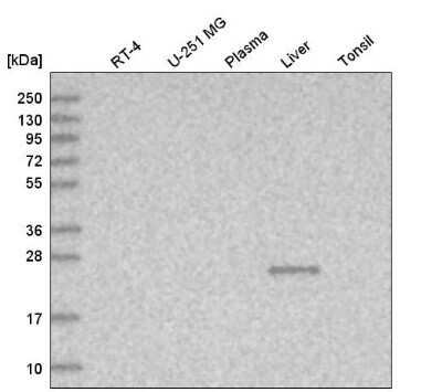 Western Blot: TTC36 Antibody [NBP1-93702] - Analysis in human cell line RT-4, human cell line U-251 MG, human plasma, human liver tissue and human tonsil tissue.