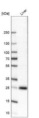 Western Blot: TTC36 Antibody [NBP1-93702] - Analysis in human liver tissue.