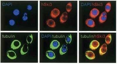 Immunocytochemistry/Immunofluorescence: TTC37 Antibody [NBP2-59165] - HeLa cells were stained with the antibody against SKI3 (in red), with DAPI to label the DNA (in blue), and with an antibody against alpha-tubulin to label the cytoplasm (in green). SKI3 is detected in both the cytoplasm and the nucleus but appears to be excluded from the nucleolus.