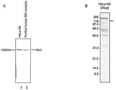 Western Blot: TTC37 Antibody [NBP2-59165] - Western blot was performed on HeLa nuclear extracts (lane 1) and on the purified human SKI complex (lane 2) (FigureA), or on nuclear extracts from HeLa cells (HeLa NE, 20 ug) (FigureB) using the antibody against SKI3 diluted 1:1,000. The location of the protein is indicated on the right, the marker (in kDa) is shown on the left.