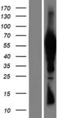Western Blot: TTC39B Overexpression Lysate (Adult Normal) [NBP2-05340] Left-Empty vector transfected control cell lysate (HEK293 cell lysate); Right -Over-expression Lysate for TTC39B.