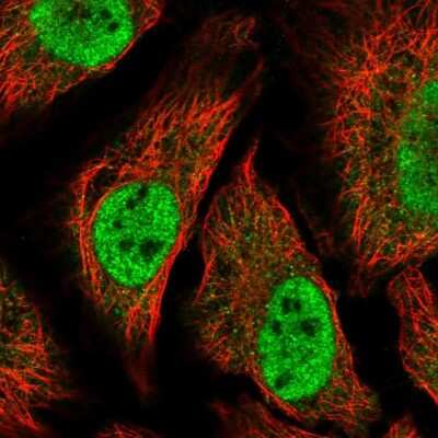 Immunocytochemistry/ Immunofluorescence TTC39C Antibody - BSA Free