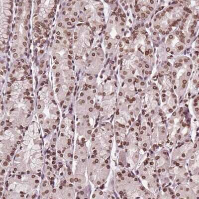 Immunohistochemistry TTC39C Antibody - BSA Free