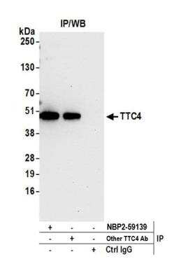 Immunoprecipitation: TTC4 Antibody [NBP2-59139] - Detection of human TTC4 by western blot of immunoprecipitates. Samples: Whole cell lysate (0.5 or 1.0 mg per IP reaction; 20% of IP loaded) from HeLa cells prepared using NETN lysis buffer. Antibodies: Affinity purified rabbit anti-TTC4 antibody NBP2-59139 used for IP at 20 ul per reaction. TTC4 was also immunoprecipitated by another rabbit anti-TTC4 antibody. For blotting immunoprecipitated TTC4, NBP2-59139 was used at 1:100. Detection: Chemiluminescence with an exposure time of 30 seconds.
