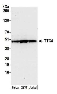 Western Blot: TTC4 Antibody [NBP2-59139] - Detection of human TTC4 by western blot. Samples: Whole cell lysate (50 ug) from HeLa, 293T, and Jurkat cells prepared using NETN lysis buffer. Antibody: Affinity purified rabbit anti-TTC4 antibody NBP2-59139 used for WB at 1:1000. Detection: Chemiluminescence with an exposure time of 30 seconds.