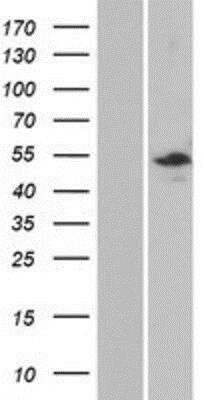 Western Blot: TTC40 Overexpression Lysate (Native) [NBP2-10231] - TTC40 Overexpression Lysate (Native) Left-Empty vector transfected control cell lysate (HEK293 cell lysate); Right -Over-expression Lysate for C10orf93.