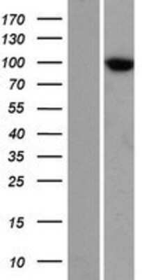 Western Blot: TTC7A Overexpression Lysate (Adult Normal) [NBP2-06642] Left-Empty vector transfected control cell lysate (HEK293 cell lysate); Right -Over-expression Lysate for TTC7A.