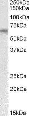 Western Blot TTC8 Antibody