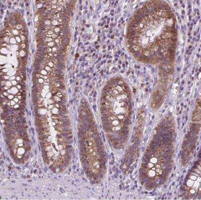 Immunohistochemistry-Paraffin TTC9B Antibody - BSA Free