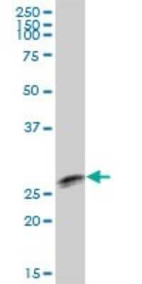 Western Blot: TTC9B Antibody [H00148014-B01P] - Analysis of TTC9B expression in rat brain.