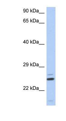 Western Blot: TTC9C Antibody [NBP1-55306] - Human Thymus lysate, concentration 0.2-1 ug/ml.