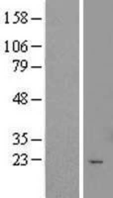 Western Blot: TTC9C Overexpression Lysate (Adult Normal) [NBL1-17414] Left-Empty vector transfected control cell lysate (HEK293 cell lysate); Right -Over-expression Lysate for TTC9C.