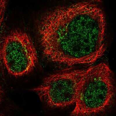 Immunocytochemistry/Immunofluorescence: TTDN1 Antibody [NBP2-31718] - Saining of human cell line A-431 shows localization to nucleoplasm &amp; the Golgi apparatus. Antibody staining is shown in green.