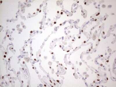 Immunohistochemistry: TTF-1 / NKX2-1 Antibody (OTI10F8) - Azide and BSA Free [NBP2-74667] - Analysis of Human lung tissue. (Heat-induced epitope retrieval by 1mM EDTA in 10mM Tris buffer (pH8.5) at 120C for 3 min)