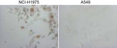 Immunohistochemistry: TTF-1 / NKX2-1 Antibody (OTI10F8) - Azide and BSA Free [NBP2-74667] - Staining of NCI-H1975 cells using anti-NKX2-1 mouse monoclonal antibody . The right is A549 cells as negative control.