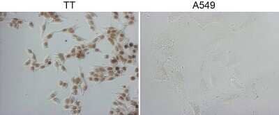 Immunohistochemistry: TTF-1 / NKX2-1 Antibody (OTI10F8) - Azide and BSA Free [NBP2-74667] - Staining of TT cells using anti-NKX2-1 mouse monoclonal antibody . The right is A549 cells as negative control.