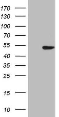 Western Blot: TTF-1 / NKX2-1 Antibody (OTI10F8) - Azide and BSA Free [NBP2-74667] - Analysis of HEK293T cells were transfected with the pCMV6-ENTRY control (Left lane) or pCMV6-ENTRY NKX2-1.