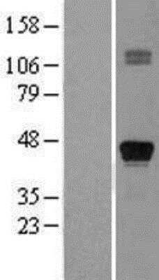 Western Blot TTF-1 / NKX2-1 Overexpression Lysate