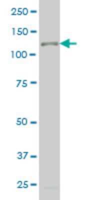 Western Blot: TTF2 Antibody (1E4) [H00008458-M10A] - Analysis of TTF2 expression in U-2 OS (Cat # L022V1).