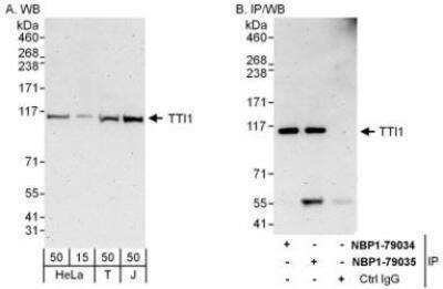 Western Blot TTI1 Antibody