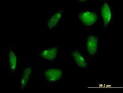 Immunocytochemistry/Immunofluorescence: TTK Antibody [H00007272-B01P] - Analysis of purified antibody to TTK on HeLa cell. (antibody concentration 10 ug/ml)