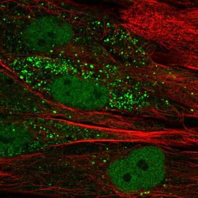 Immunocytochemistry/Immunofluorescence: TTL Antibody [NBP2-57533] - Staining of human cell line BJ shows localization to nucleoplasm & vesicles.