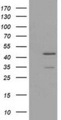 Western Blot: TTL Antibody (OTI3G5) - Azide and BSA Free [NBP2-74668] - HEK293T cells were transfected with the pCMV6-ENTRY control (Left lane) or pCMV6-ENTRY TTL (Right lane) cDNA for 48 hrs and lysed. Equivalent amounts of cell lysates (5 ug per lane) were separated by SDS-PAGE and immunoblotted with anti-TTL.