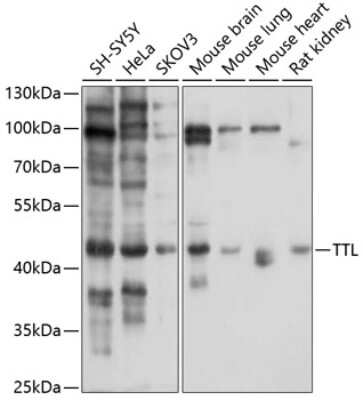 Western Blot: TTL Antibody [NBP2-95124] - Analysis of extracts of various cell lines, using TTL at 1:1000 dilution. Secondary antibody: HRP Goat Anti-Rabbit IgG (H+L) at 1:10000 dilution. Lysates/proteins: 25ug per lane. Blocking buffer: 3% nonfat dry milk in TBST. Detection: ECL Basic Kit . Exposure time: 10s.