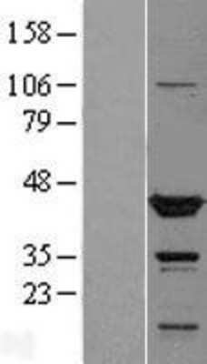 Western Blot: TTL Overexpression Lysate (Adult Normal) [NBL1-17416] Left-Empty vector transfected control cell lysate (HEK293 cell lysate); Right -Over-expression Lysate for TTL.