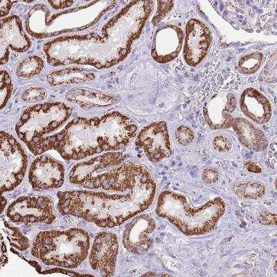 Immunohistochemistry-Paraffin: TTLL1 Antibody [NBP2-13491] - Staining of human kidney shows strong granular cytoplasmic positivity in cells in tubules.