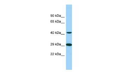 Western Blot: TTLL1 Antibody [NBP2-88513] - Host: Rabbit. Target Name: TTLL1. Sample Type: 721_B whole cell lysates. Antibody Dilution: 1.0ug/ml