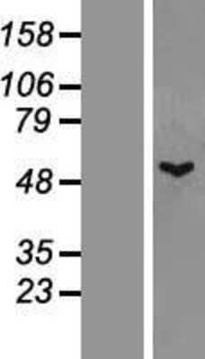 Western Blot: TTLL1 Overexpression Lysate (Adult Normal) [NBL1-17417] Left-Empty vector transfected control cell lysate (HEK293 cell lysate); Right -Over-expression Lysate for TTLL1.