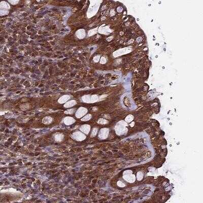 Immunohistochemistry-Paraffin: TTLL10 Antibody [NBP1-93819] - Staining of human rectum shows moderate cytoplasmic positivity in glandular cells.