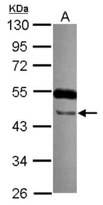 Western Blot: TTLL10 Antibody [NBP2-20755] - Sample (30 ug of whole cell lysate) A: NT2D1 10% SDS PAGE gel, diluted at 1:1000.