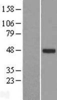 Western Blot: TTLL10 Overexpression Lysate (Adult Normal) [NBP2-05280] Left-Empty vector transfected control cell lysate (HEK293 cell lysate); Right -Over-expression Lysate for TTLL10.