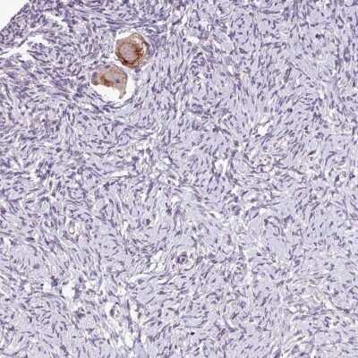 Immunohistochemistry-Paraffin TTLL3 Antibody - BSA Free