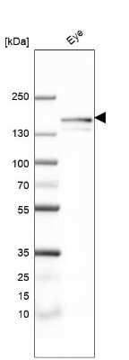 Western Blot: TTLL4 Antibody [NBP2-55634] - Analysis in human eye tissue.