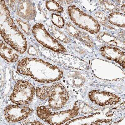 Immunohistochemistry-Paraffin: TTLL8 Antibody [NBP1-91090] - Staining of human kidney shows distinct cytoplasmic positivity in cells in tubules.
