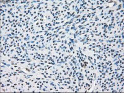 Immunohistochemistry-Paraffin: TTP Antibody (8B5) [NBP2-02105] - Staining of paraffin-embedded Human endometrium tissue using anti-TTP mouse monoclonal antibody.