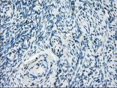 Immunohistochemistry-Paraffin: TTP Antibody (8B5) [NBP2-02105] - Staining of paraffin-embedded Human Ovary tissue using anti-TTP mouse monoclonal antibody.