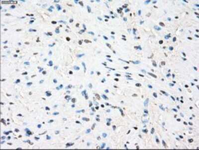 Immunohistochemistry-Paraffin: TTP Antibody (8B5) [NBP2-02105] - Staining of paraffin-embedded Human prostate tissue using anti-TTP mouse monoclonal antibody.