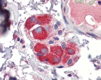 Immunohistochemistry-Paraffin: TTP Antibody [NBP2-86884] - IHC Information: Paraffin embedded small intestine, submucosal plexus tissue, tested with an antibody Dilution of 5 ug/ml.