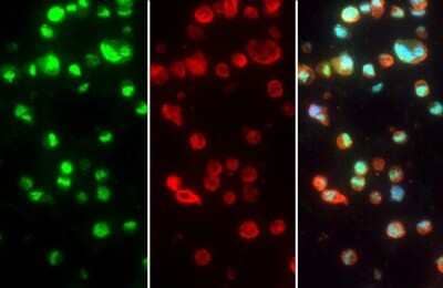 Immunohistochemistry-Paraffin: TTP Antibody [NBP3-12978] - TTP antibody detects TTP protein at nucleus by immunohistochemical analysis. Sample: Paraffin-embedded human THP-1. Green: TTP stained by TTP antibody (NBP3-12978) diluted at 1:250. Red: alpha Tubulin, a cytoskeleton marker, stained by alpha Tubulin antibody [GT114] (NBP2-43837) diluted at 1:1000. Blue: Fluoroshield with DAPI. Antigen Retrieval: Citrate buffer, pH 6.0, 15 min